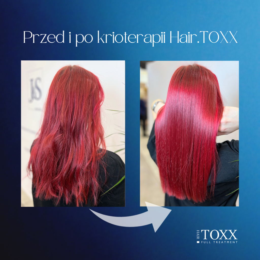 Przed i po krioterapii Hair.TOXX (Post na Instagram (Kwadrat)) (Wpis na Facebooku) (Post Instagram) (Post Instagram) (1)